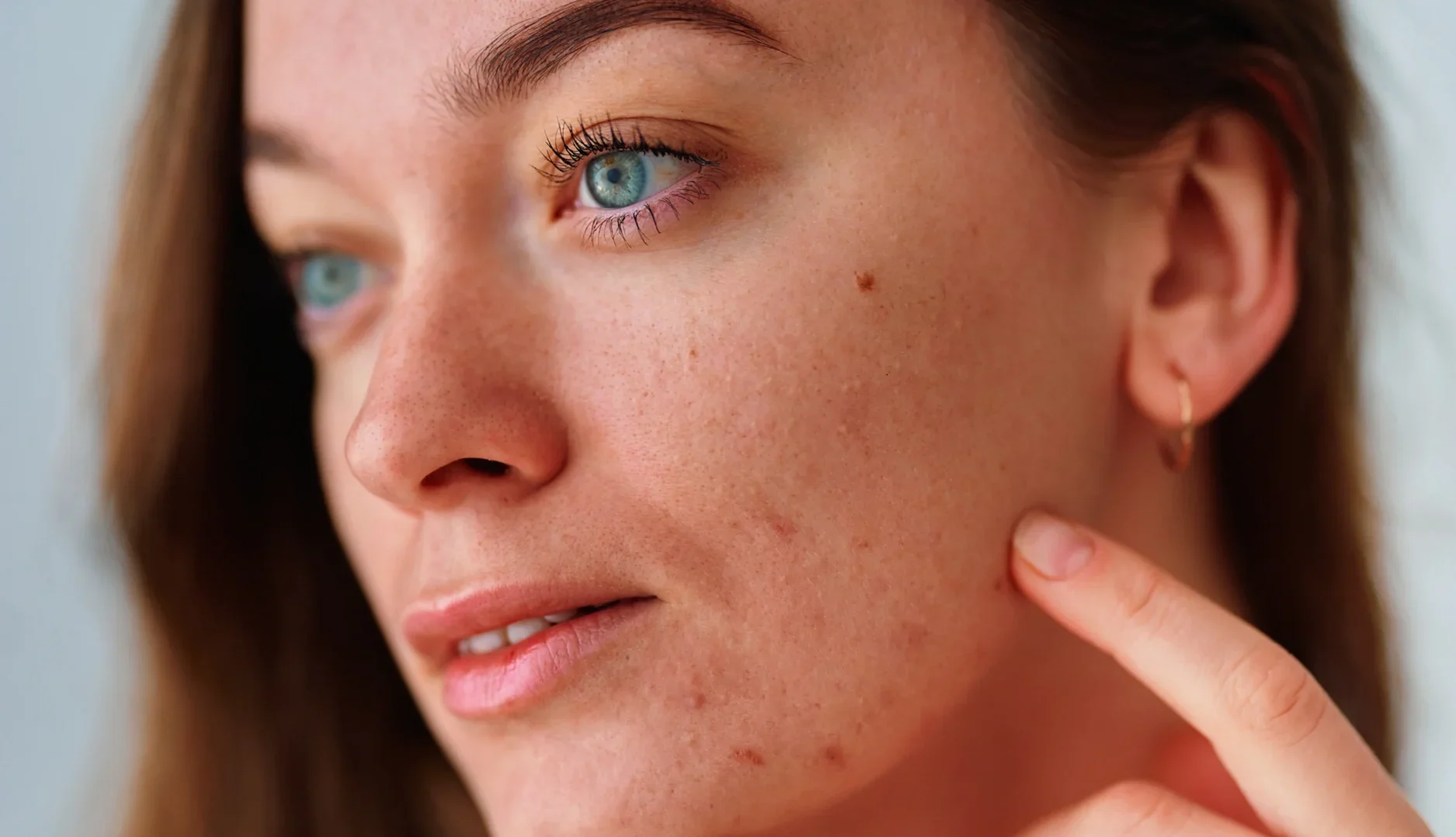 Cuidados Pele Oleosa: Dicas, produtos e skincare.